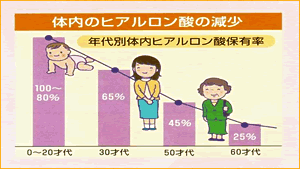 �̓��̃q�A�������_�̌���