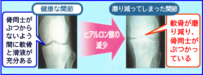 �q�A�������_����������ƁA�����m���Ԃ���₷���c�c