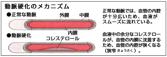 �����d���̃��J�j�Y��