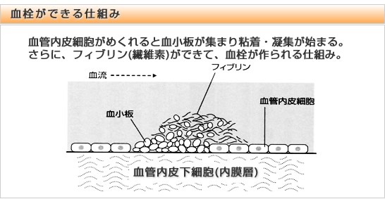 �������ł���d�g��