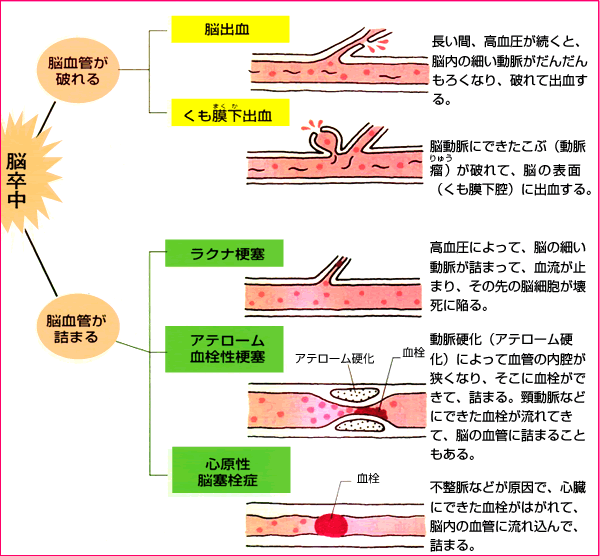 �|���]�̕a�C