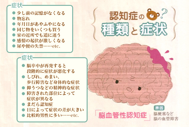 �F�m�ǂ̎�ނƏǏ�