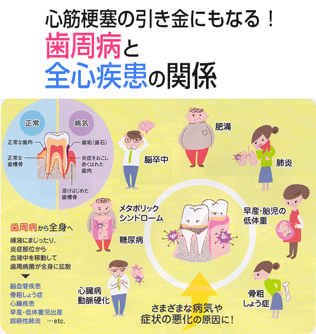 �S�؍[�ǂ̈������ɂ��Ȃ�I�����a�ƑS�g�����̊֌W