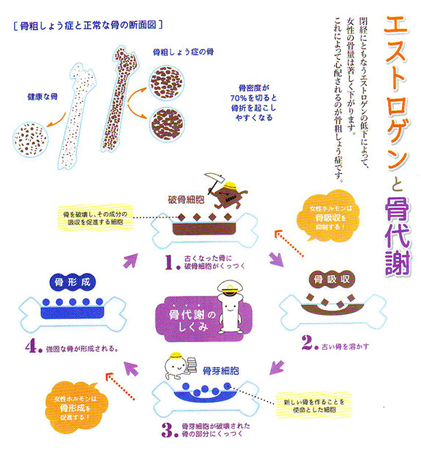 �G�X�g���Q���ƍ����